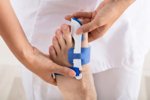 Can Bunion Correctors Actually Correct Bunions